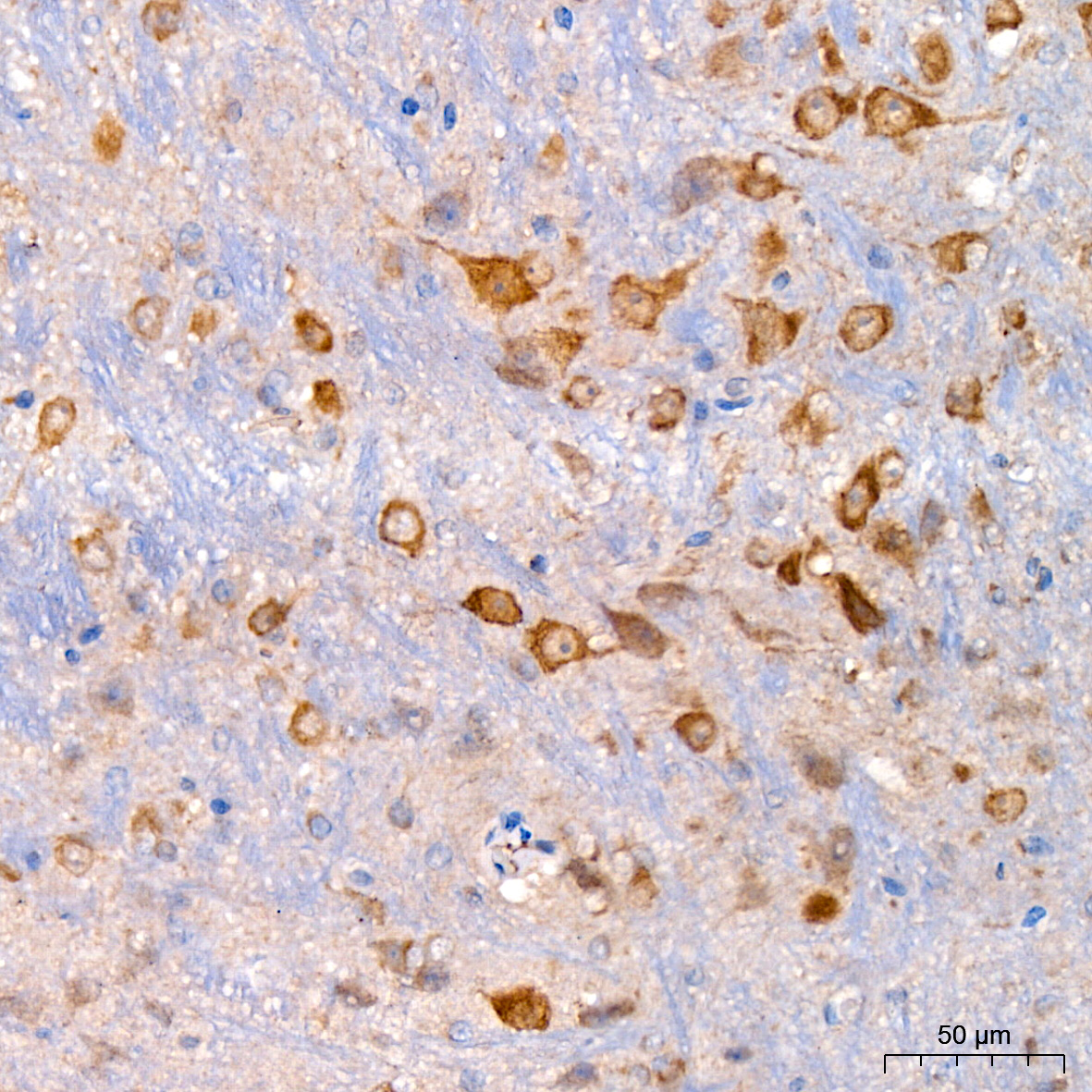 Xanthine Oxidase (XDH) Rabbit monoclonal antibody