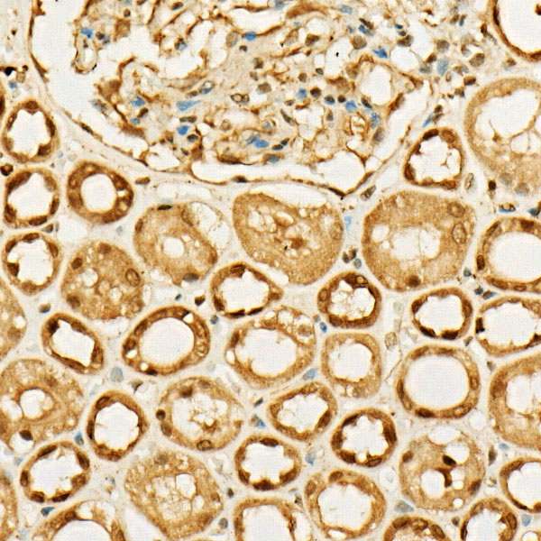 MGEA5 Rabbit polyclonal antibody