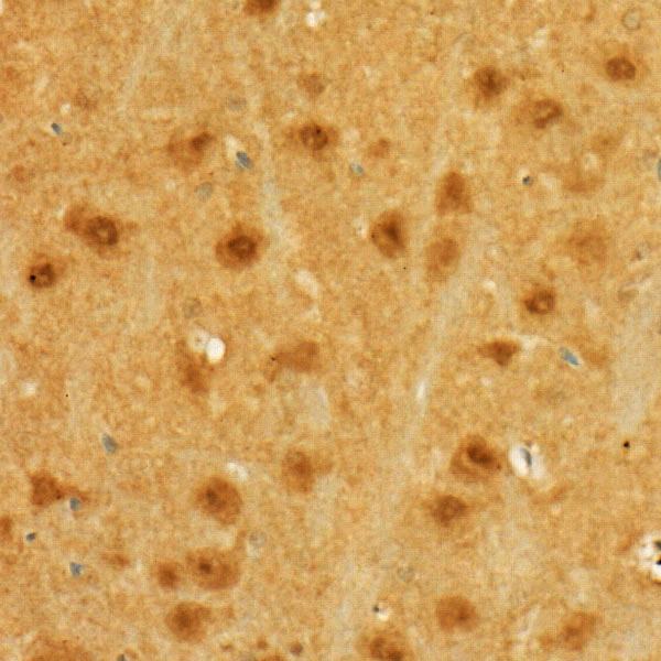 MGEA5 Rabbit polyclonal antibody