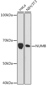 NUMB Rabbit monoclonal antibody