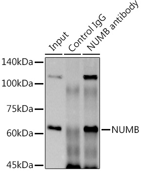 NUMB Rabbit monoclonal antibody