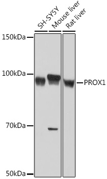 PROX1 Rabbit monoclonal antibody