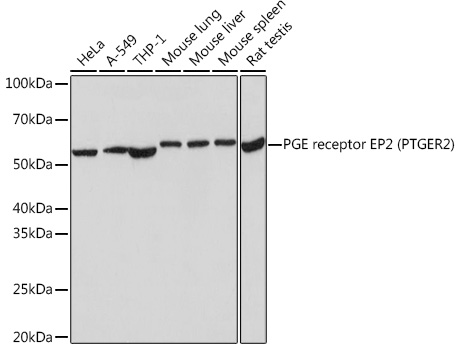 PGE receptor EP2 (PTGER2) Rabbit monoclonal antibody