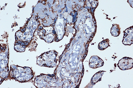 PGE receptor EP2 (PTGER2) Rabbit monoclonal antibody