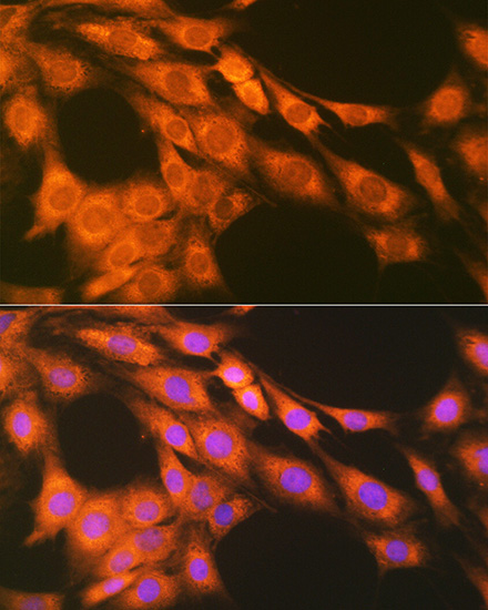PGE receptor EP2 (PTGER2) Rabbit monoclonal antibody