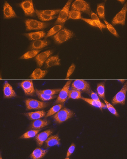 PGE receptor EP2 (PTGER2) Rabbit monoclonal antibody