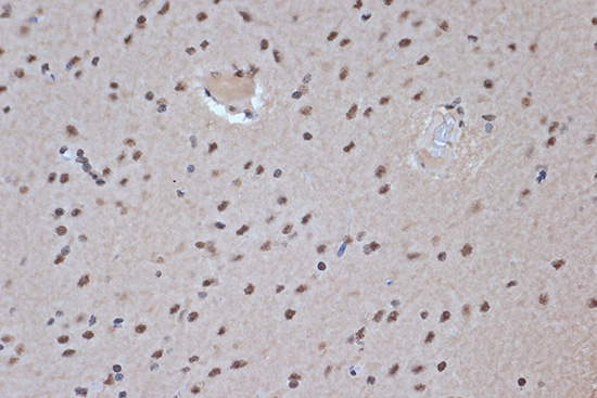 SRSF3 Rabbit monoclonal antibody