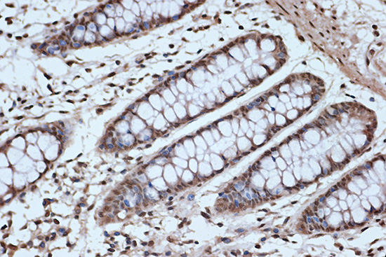 SRSF3 Rabbit monoclonal antibody