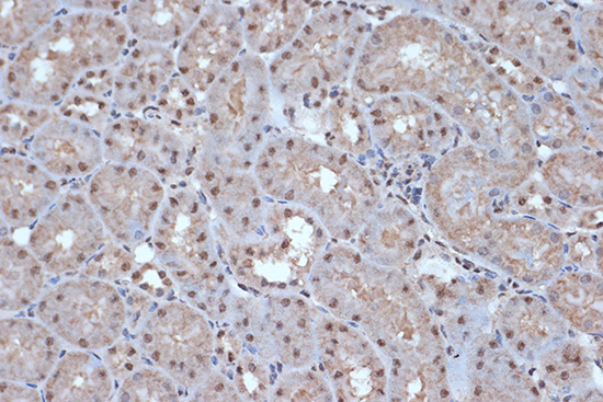 SRSF3 Rabbit monoclonal antibody