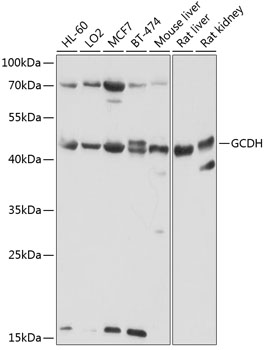 GCDH Rabbit polyclonal antibody