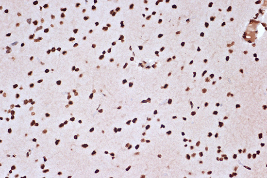 macroH2A.1 Rabbit monoclonal antibody