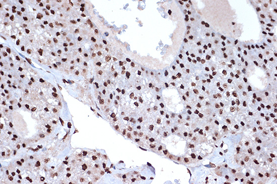 macroH2A.1 Rabbit monoclonal antibody