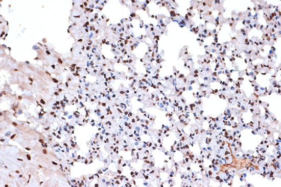 macroH2A.1 Rabbit monoclonal antibody