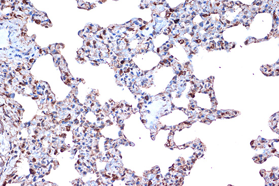 PDCD4 Rabbit monoclonal antibody
