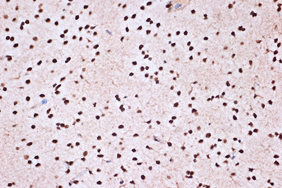 KHSRP Rabbit monoclonal antibody