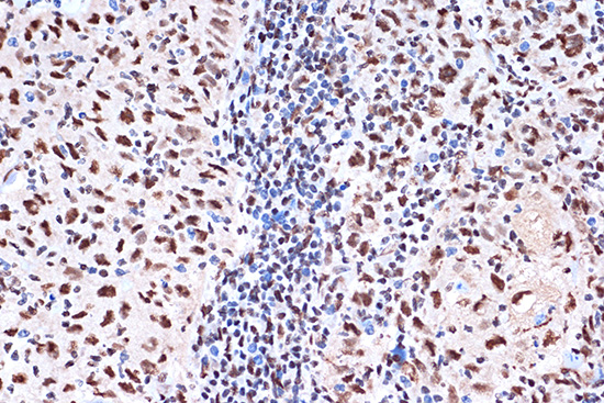 KHSRP Rabbit monoclonal antibody