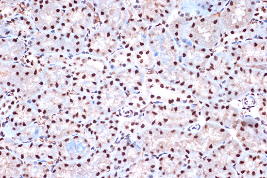 KHSRP Rabbit monoclonal antibody