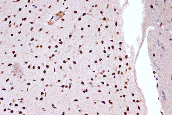 FUBP1 Rabbit monoclonal antibody