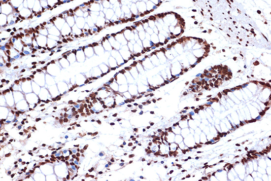 FUBP1 Rabbit monoclonal antibody