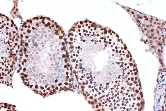 FUBP1 Rabbit monoclonal antibody