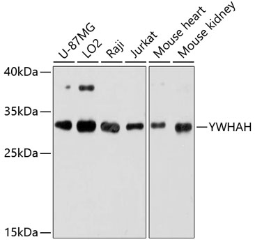 YWHAH Rabbit polyclonal antibody
