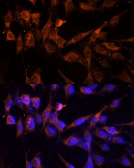 YWHAH Rabbit polyclonal antibody