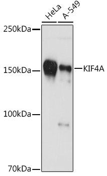 KIF4A Rabbit monoclonal antibody