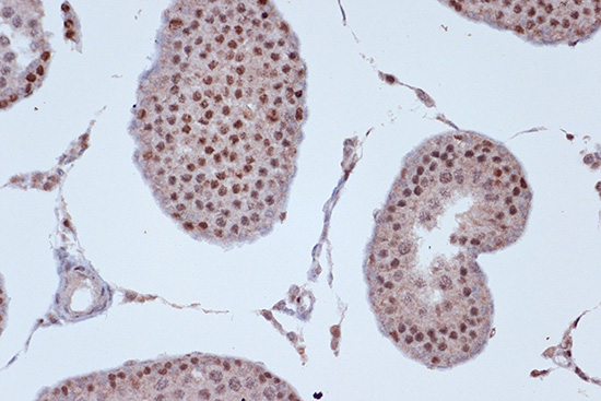 KIF4A Rabbit monoclonal antibody