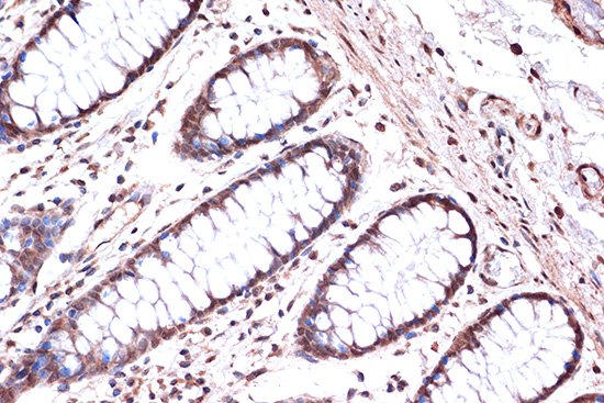 KIF4A Rabbit monoclonal antibody