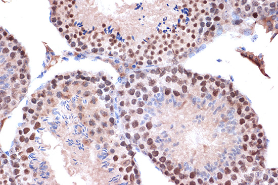 KIF4A Rabbit monoclonal antibody