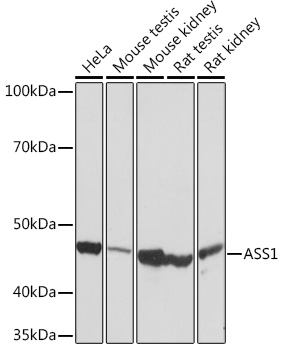 ASS1 Rabbit monoclonal antibody