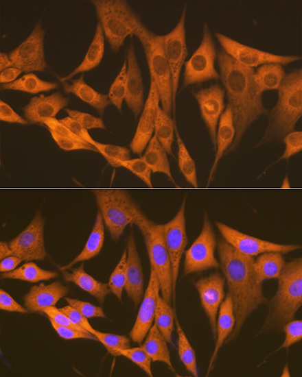 ASS1 Rabbit monoclonal antibody