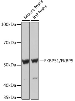 FKBP51/FKBP5 Rabbit monoclonal antibody