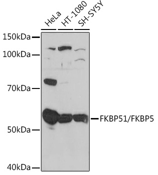 FKBP51/FKBP5 Rabbit monoclonal antibody