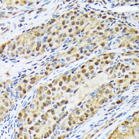 FKBP51/FKBP5 Rabbit monoclonal antibody