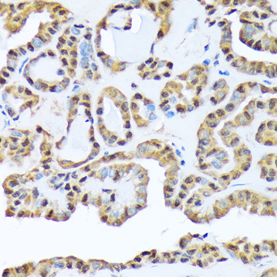 FKBP51/FKBP5 Rabbit monoclonal antibody
