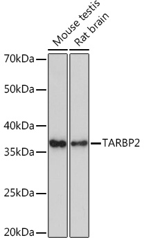 TARBP2 Rabbit monoclonal antibody