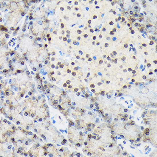 TARBP2 Rabbit monoclonal antibody