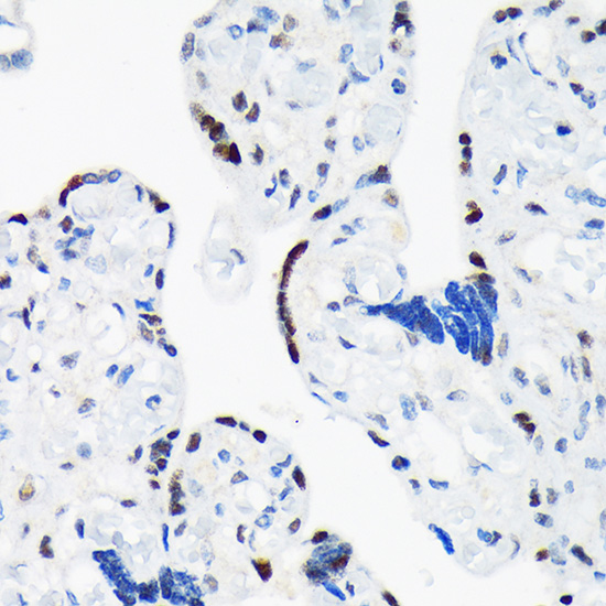 TARBP2 Rabbit monoclonal antibody