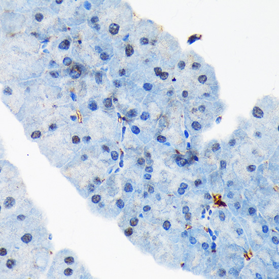 TARBP2 Rabbit monoclonal antibody