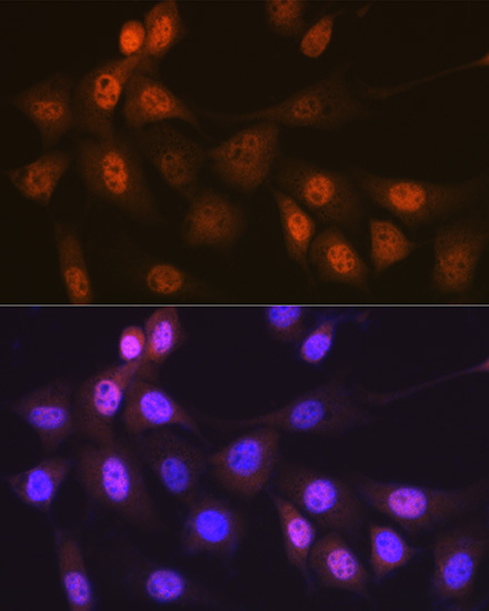 Musashi-1 (MSI1) Rabbit monoclonal antibody