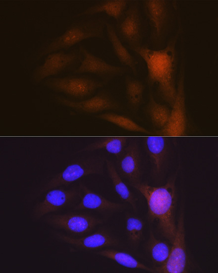 Musashi-1 (MSI1) Rabbit monoclonal antibody