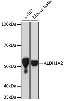 ALDH1A2 Rabbit monoclonal antibody