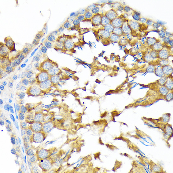 ALDH1A2 Rabbit monoclonal antibody
