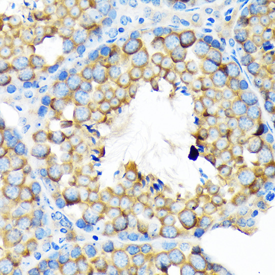 ALDH1A2 Rabbit monoclonal antibody