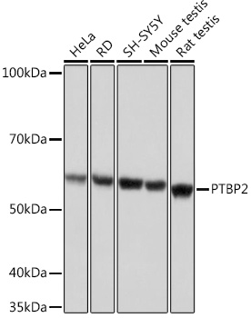 PTBP2 Rabbit monoclonal antibody