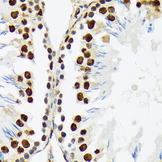 PTBP2 Rabbit monoclonal antibody