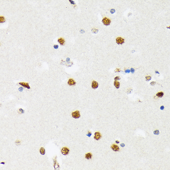 PTBP2 Rabbit monoclonal antibody