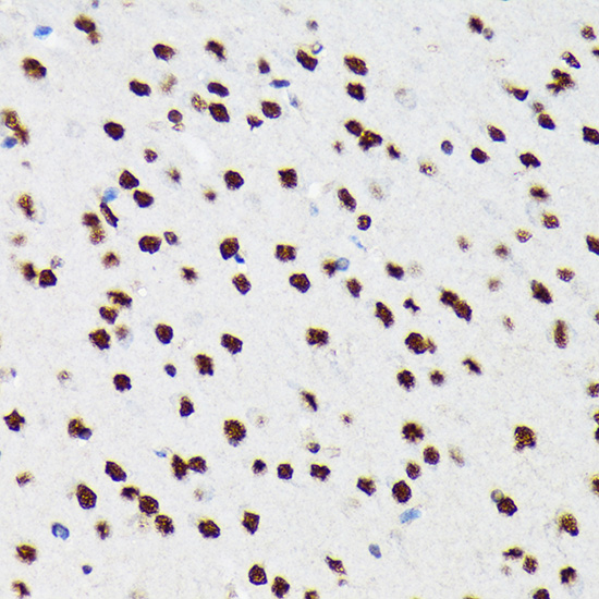 PTBP2 Rabbit monoclonal antibody