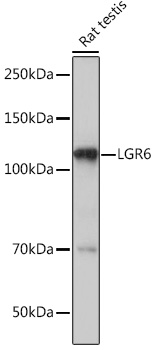LGR6 Rabbit monoclonal antibody